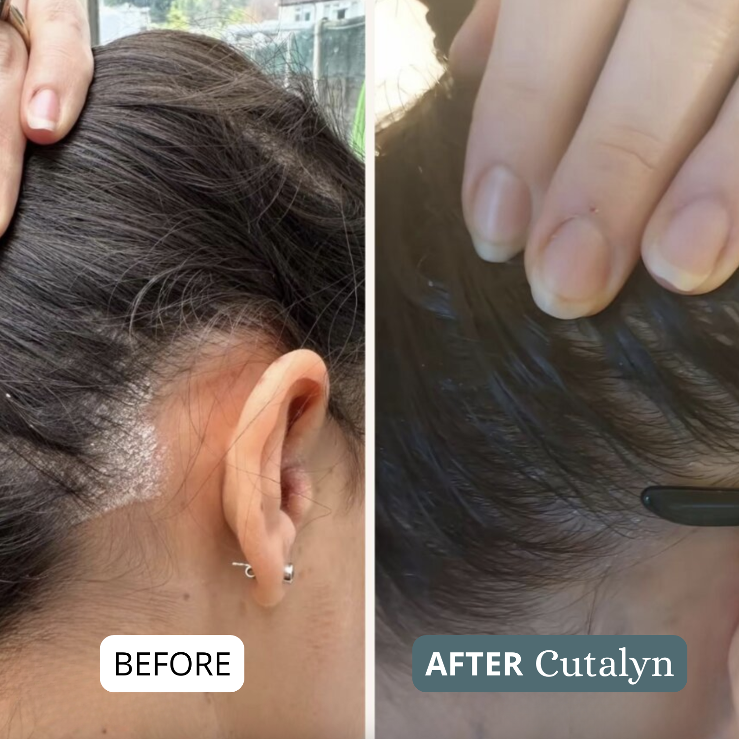 SensiCalm® Soothing Cream ⎜ For a clean, calm & balanced scalp