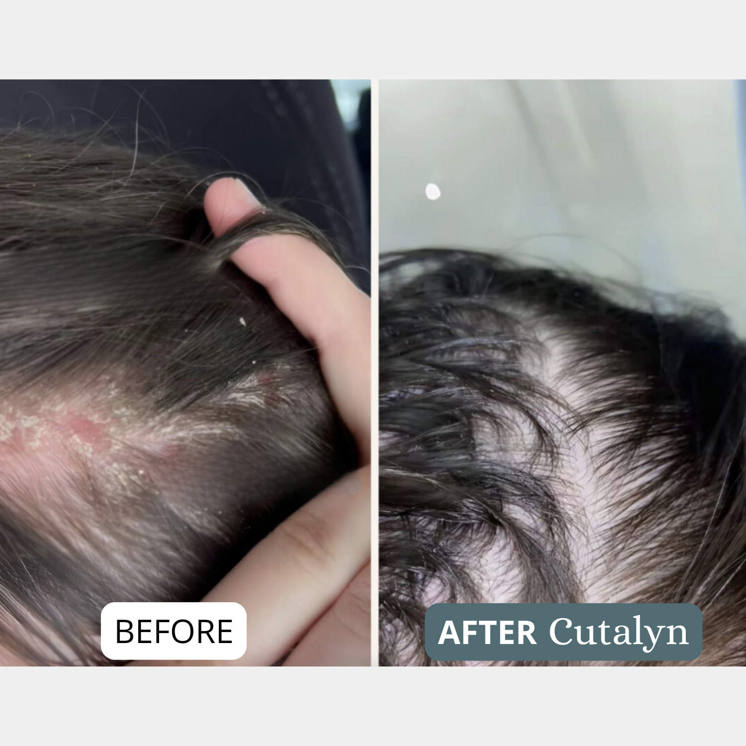 SensiCalm® Soothing Cream ⎜ For a clean, calm & balanced scalp