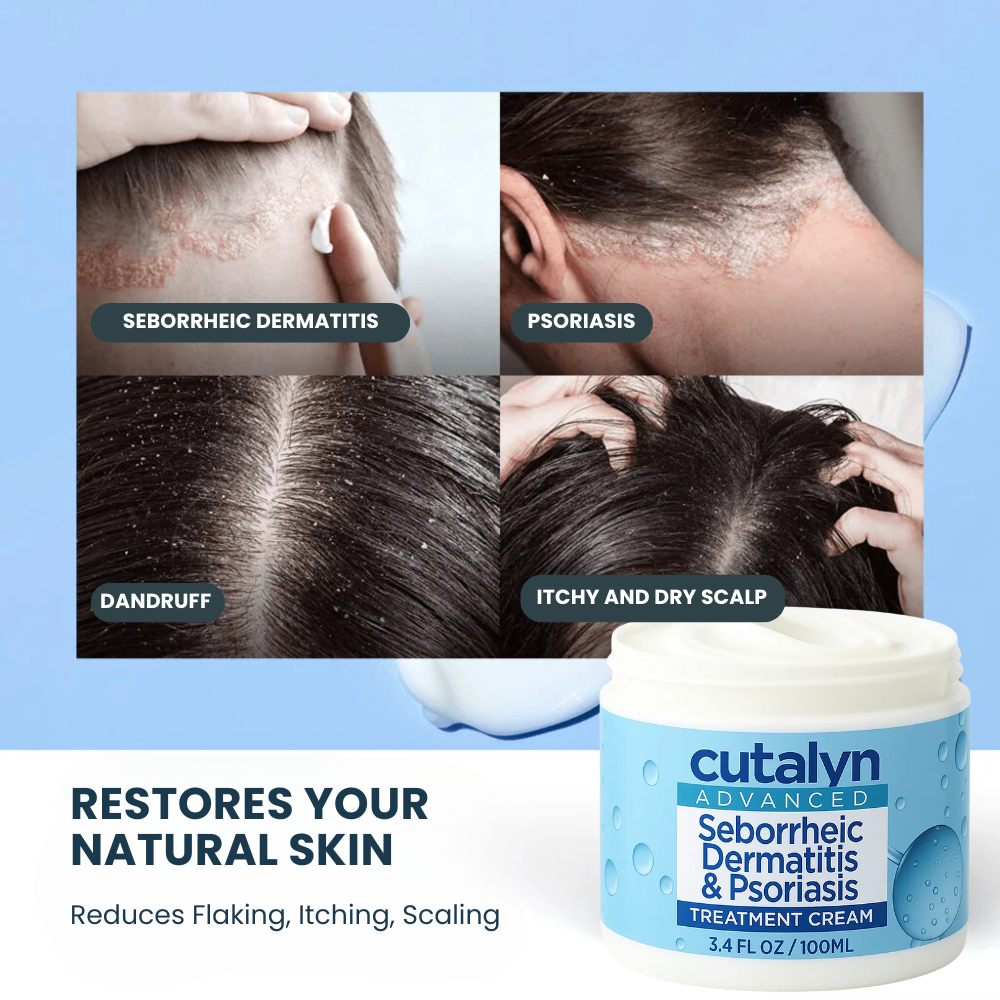 SensiCalm® Soothing Cream ⎜ For a clean, calm & balanced scalp